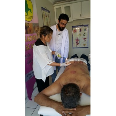 HACAMAT UZMANI ve SÜLÜK TERAPİSTİ OSMAN HOCA